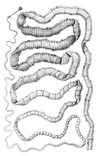 Taenia solium