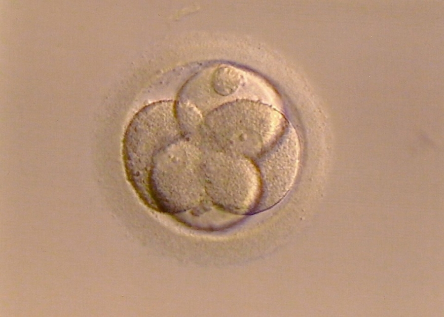 An early stage of Embryo development