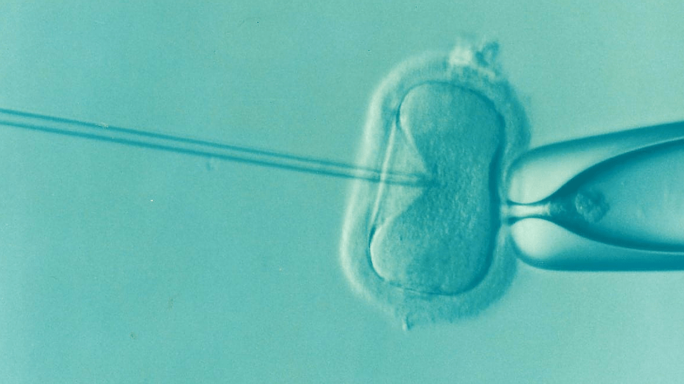 In future, 3 parent ivf technique is expected to emerge as more efficient method than conventional ivf treatment.
