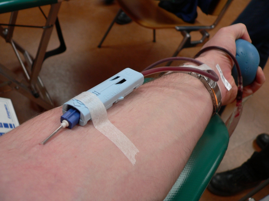 Blood donation and donors are required for this controversial procedure