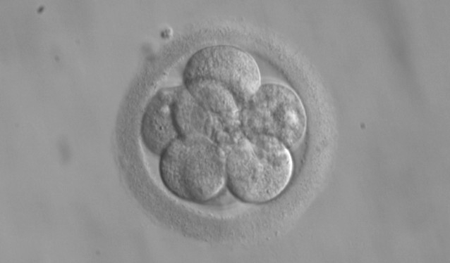 8-cell human embryo for transfer, 3 days after fertilization