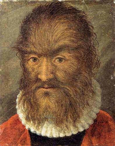 Petrus Gonsalvus (Inspiration behind Beast in the Beauty & Beast Story - suffered from Hypertrichosis).