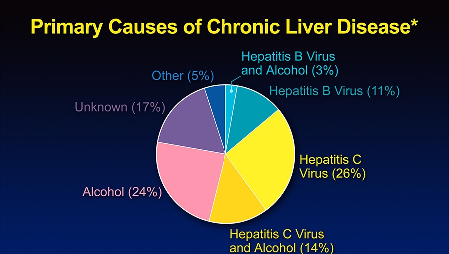 Pie chart showing role of Hepatitis virus in Chronic Liver Disease (from a study in Jefferson County, Alabama, USA)